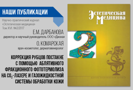 Коррекция рубцов постакне. Эстетическая медицина 02/2017