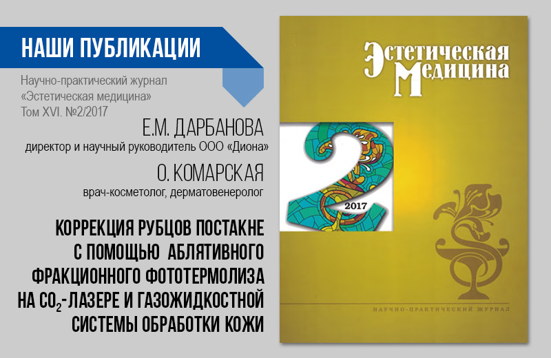 Коррекция рубцов постакне. Эстетическая медицина 02/2017